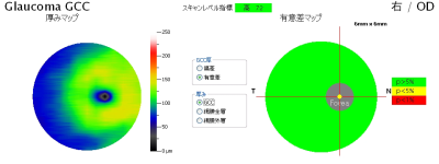 高機能OCT RTVue-100